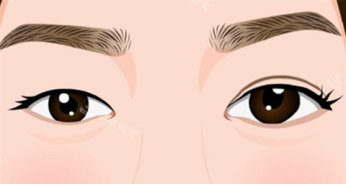 宁波全切双眼皮哪里靠谱？宁波第三医院整形科技术精、案例多